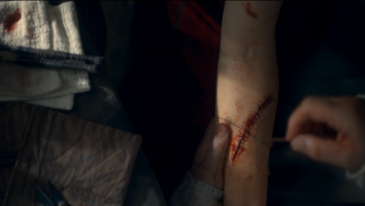 Rhaenyra's cut arm after Alicent attacks her